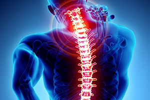 Neuro and Spine Surgery